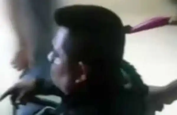 Peruvian man walks into hospital with knife sticking out of his head (video/pics)